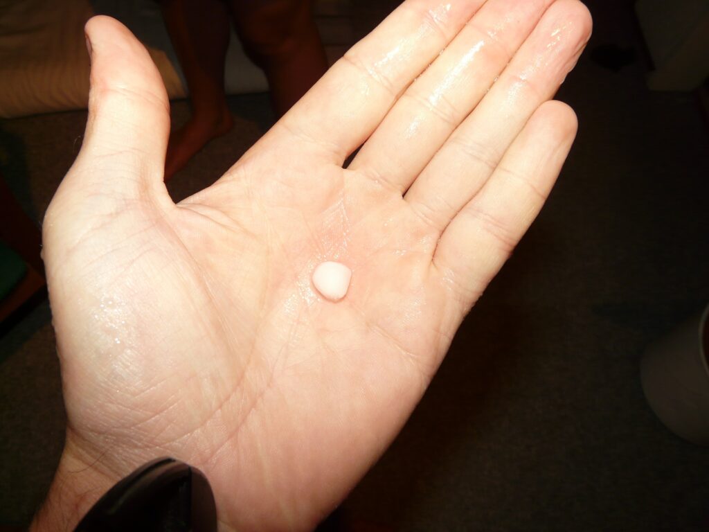 hailstone-5036